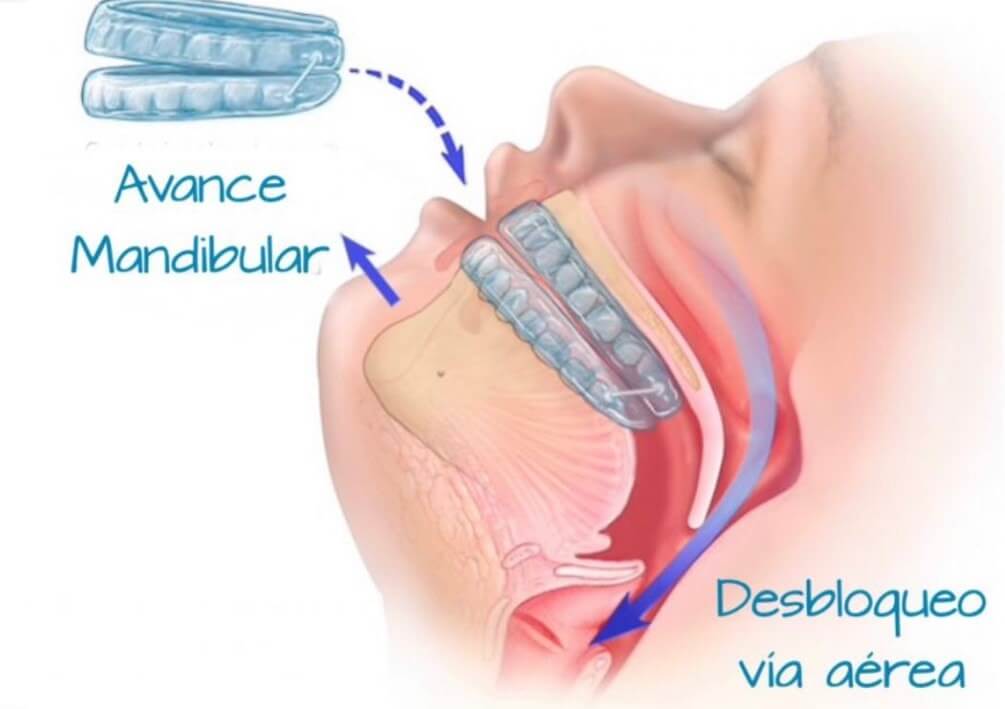 dentista en dubai español vivir